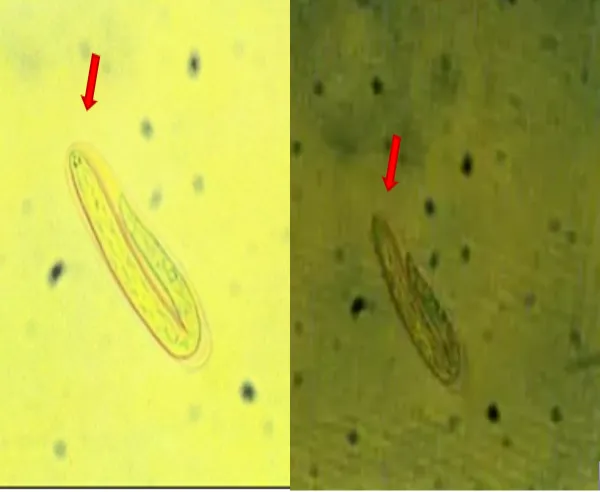 Huevo del nematodo habronema spp