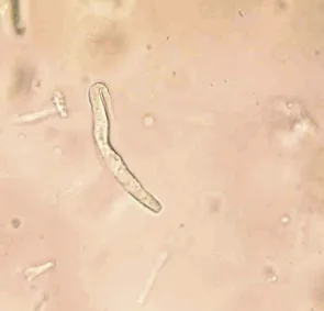 Larva de habronema spp